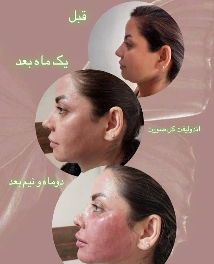 کلینیک زیبایی و لیزر سولی بیوتی در شیراز