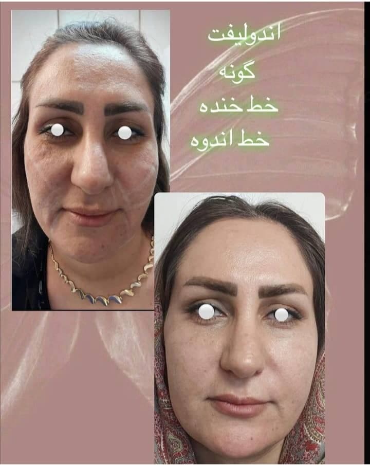 کلینیک زیبایی و لیزر سولی بیوتی در شیراز