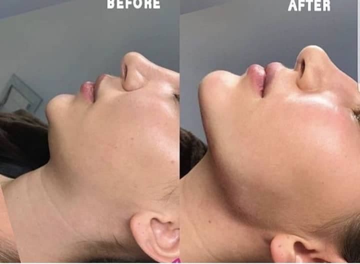 کلینیک زیبایی و لیزر سولی بیوتی در شیراز