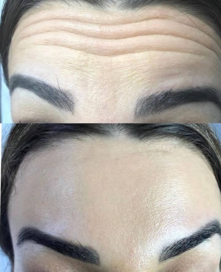 کلینیک زیبایی و لیزر سولی بیوتی در شیراز