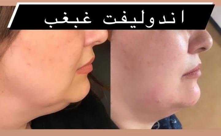 کلینیک زیبایی و لیزر سولی بیوتی در شیراز