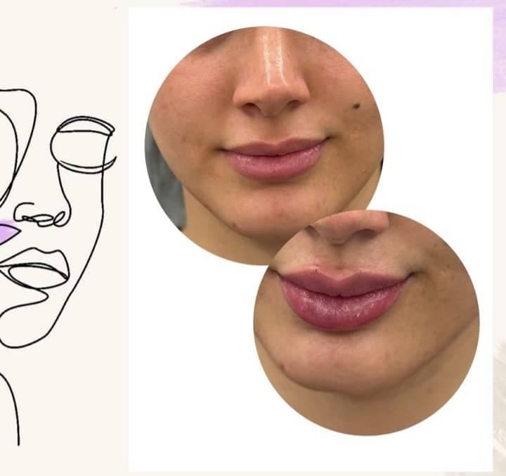 کلینیک زیبایی و لیزر سولی بیوتی در شیراز