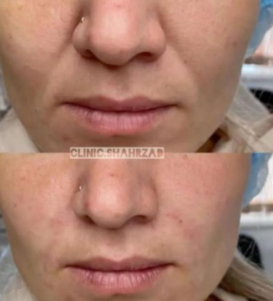 کلینیک پوست و لیزر شهرزاد در جهانشهر کرج