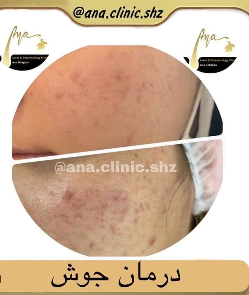 کلینیک زیبایی آنا در شیراز