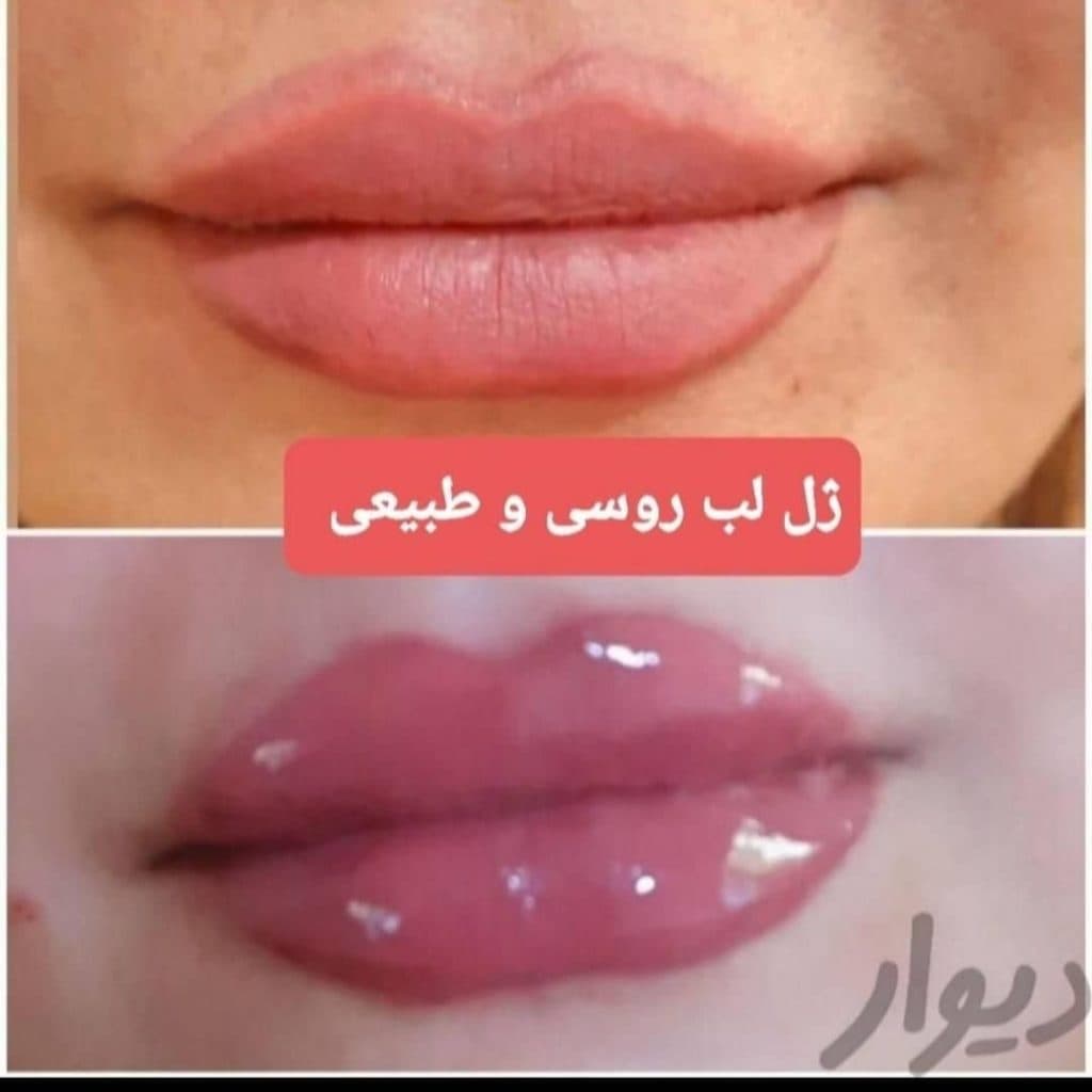 کلینیک پزشکی و زیبایی پوست مو سایه در نواب رشت