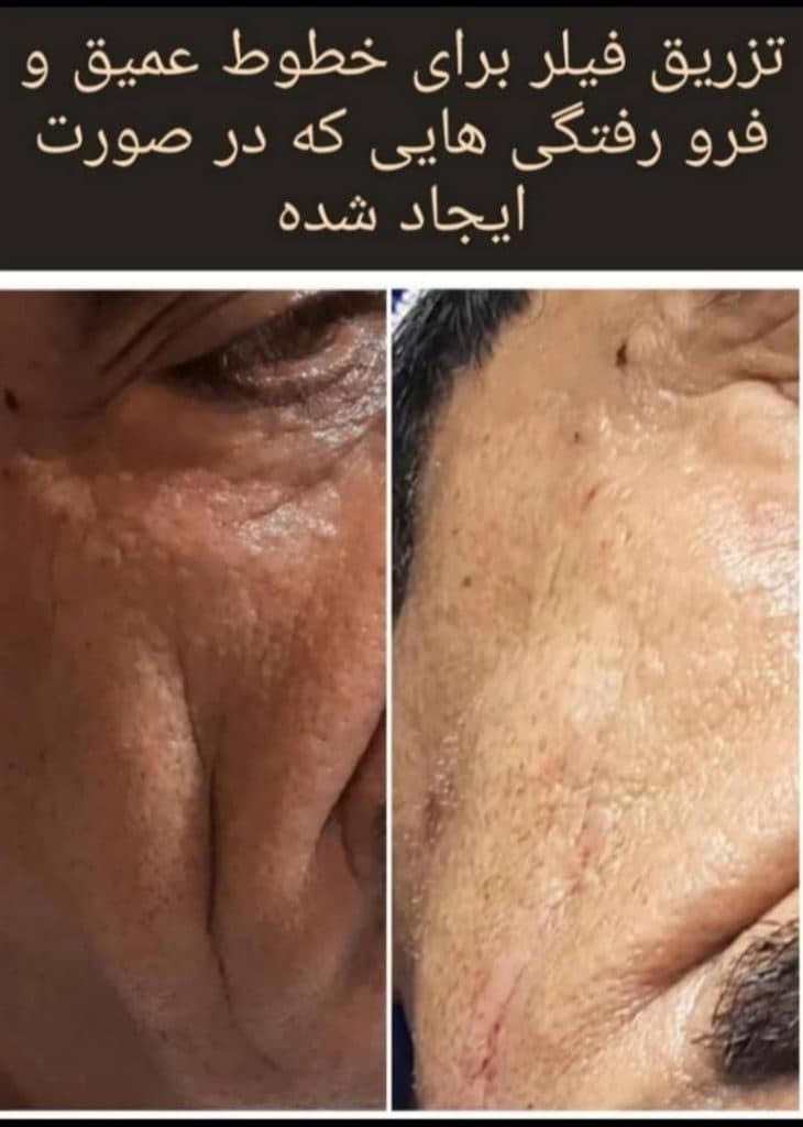 کلینیک پزشکی و زیبایی پوست مو سایه در نواب رشت