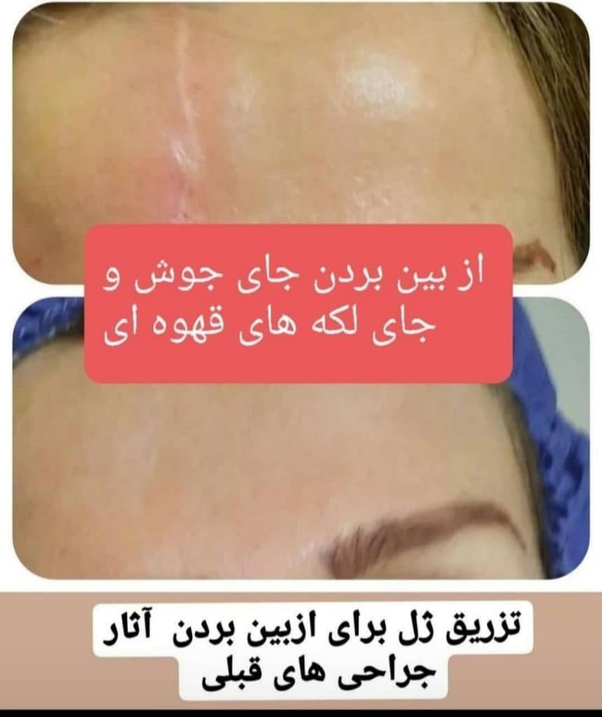 کلینیک پزشکی و زیبایی پوست مو سایه در نواب رشت