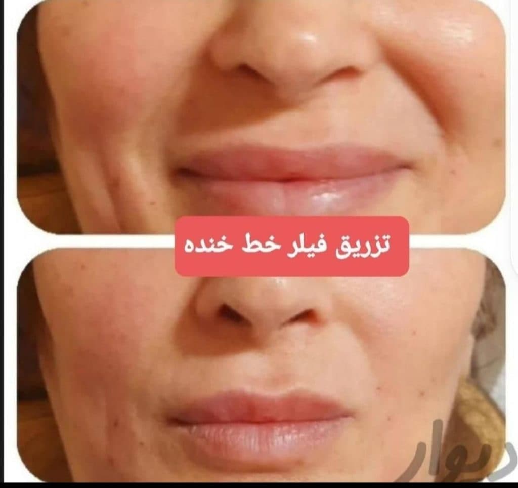 کلینیک پزشکی و زیبایی پوست مو سایه در نواب رشت