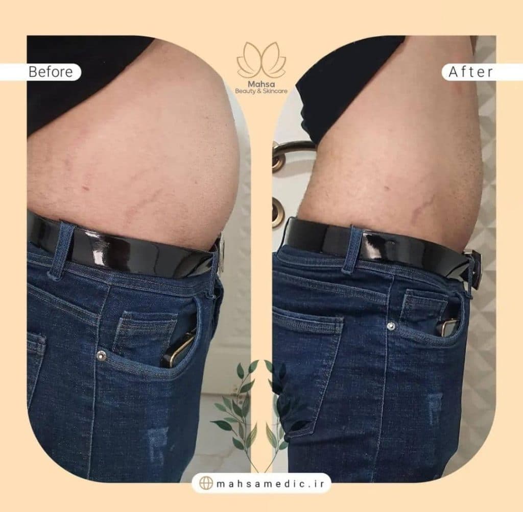 کلینیک زیبایی لیزر پوست مو و فشیال و لاغری مهسا در شیراز