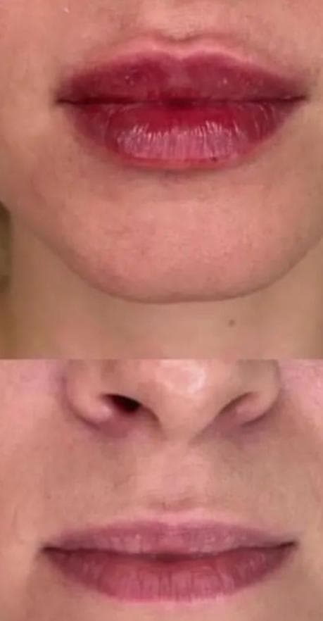 کلینیک زیبایی به سما در رشت