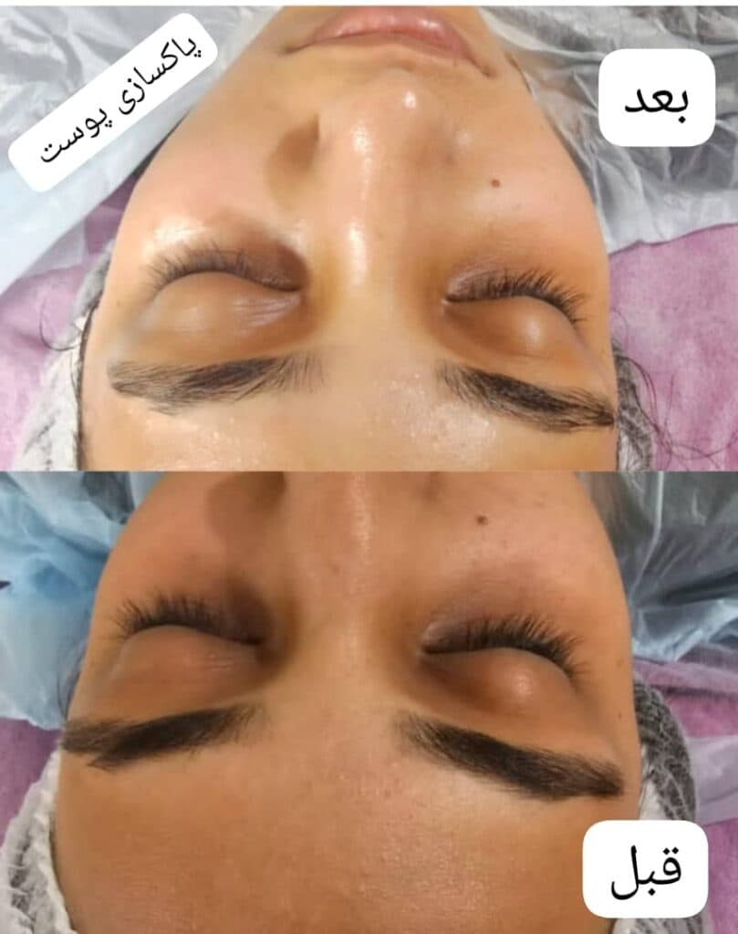 کلینیک تخصصی زیبایی پوست مو و لیزر رز سفید در شیراز