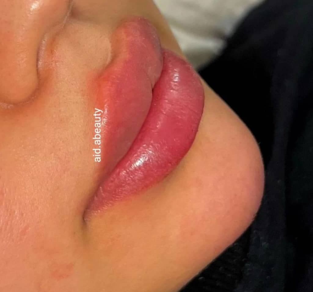 کلینیک زیبایی آیدا اقبالی در شیراز