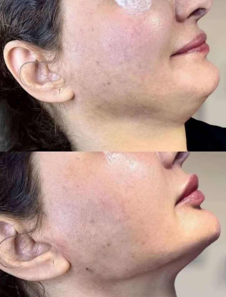 کلینیک زیبایی پریان بیوتی در احمدآباد مشهد