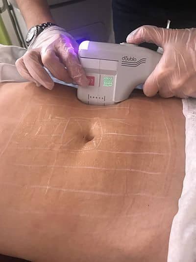 کلینیک زیبایی پریان بیوتی در احمدآباد مشهد