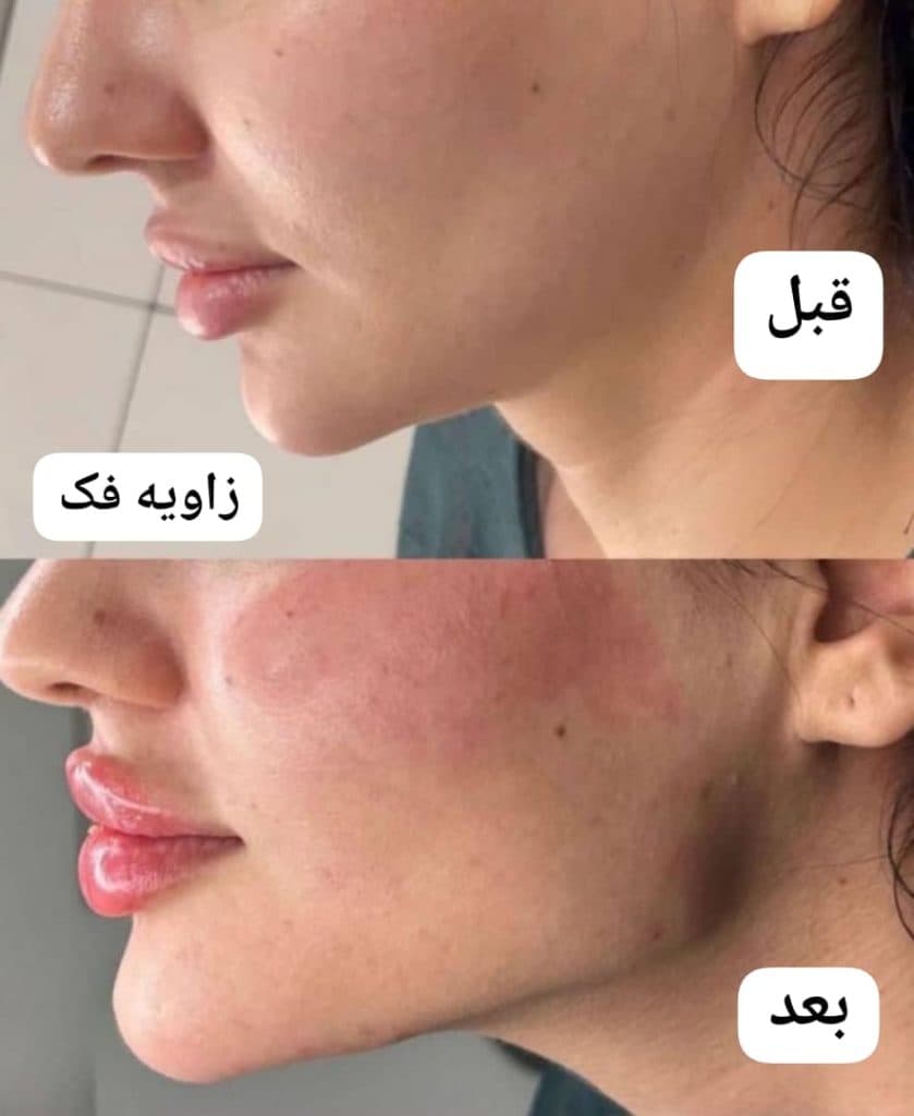 کلینیک زیبایی پوست و مو سایه در مشهد