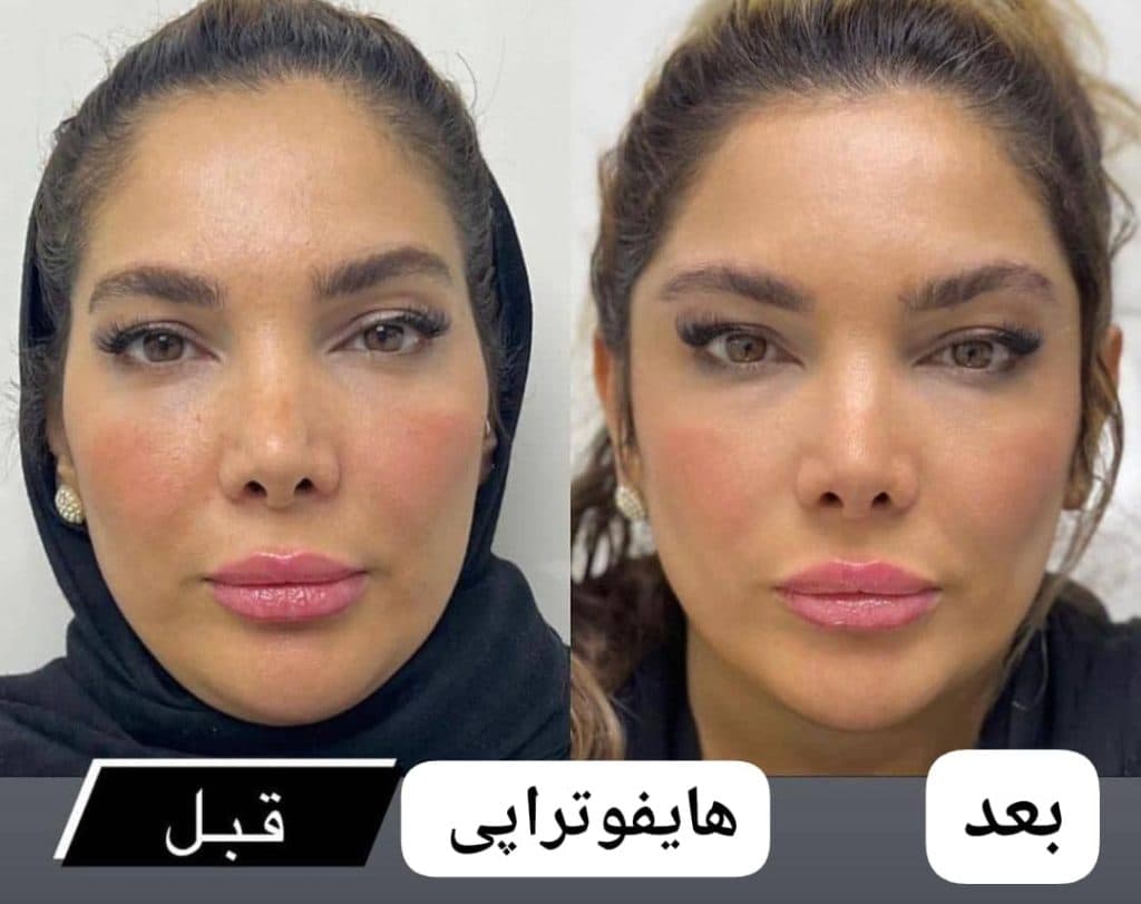 کلینیک زیبایی پوست و مو سایه در مشهد