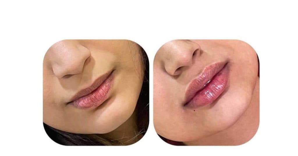 کلینیک پوست و مو فاطیما در رشت