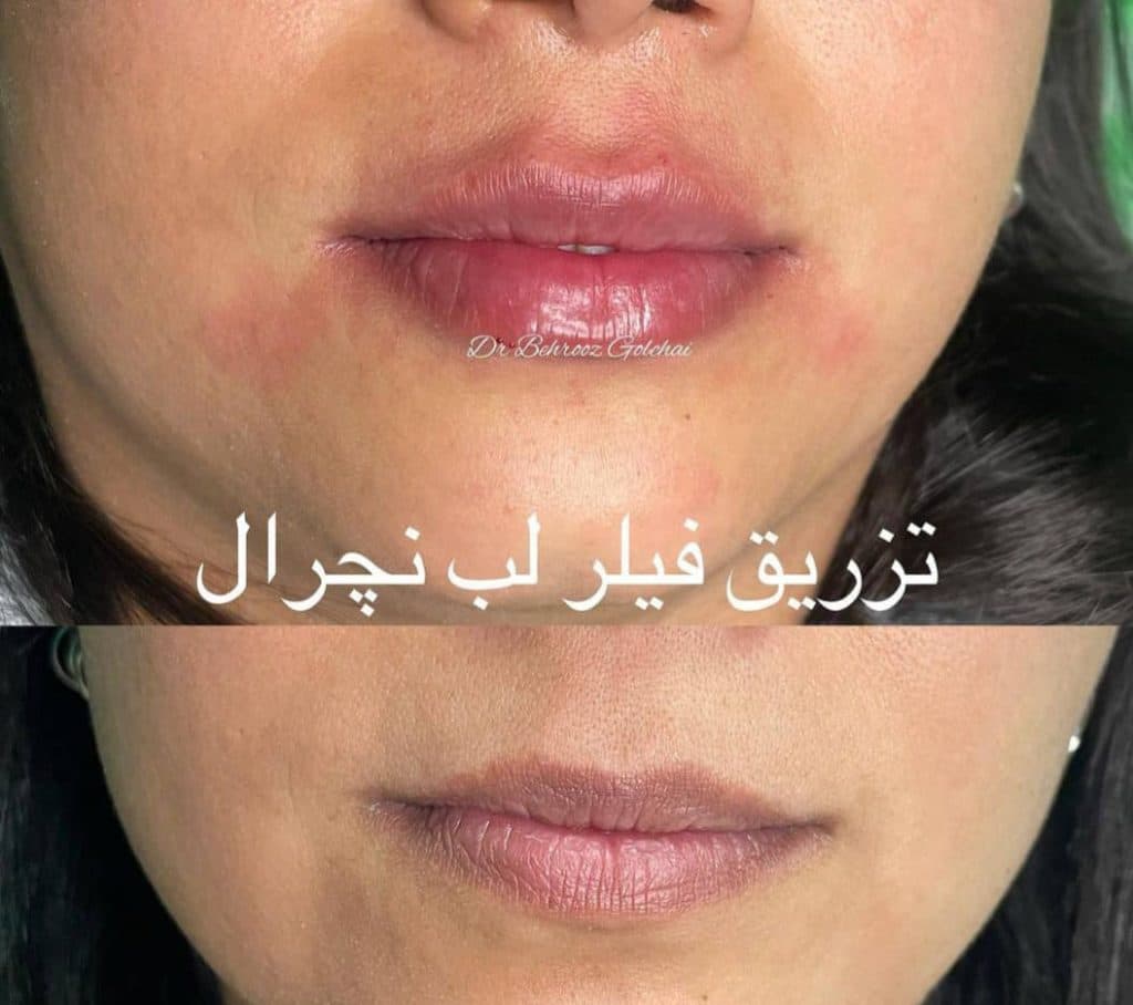 کلینیک پوست و مو فاطیما در رشت