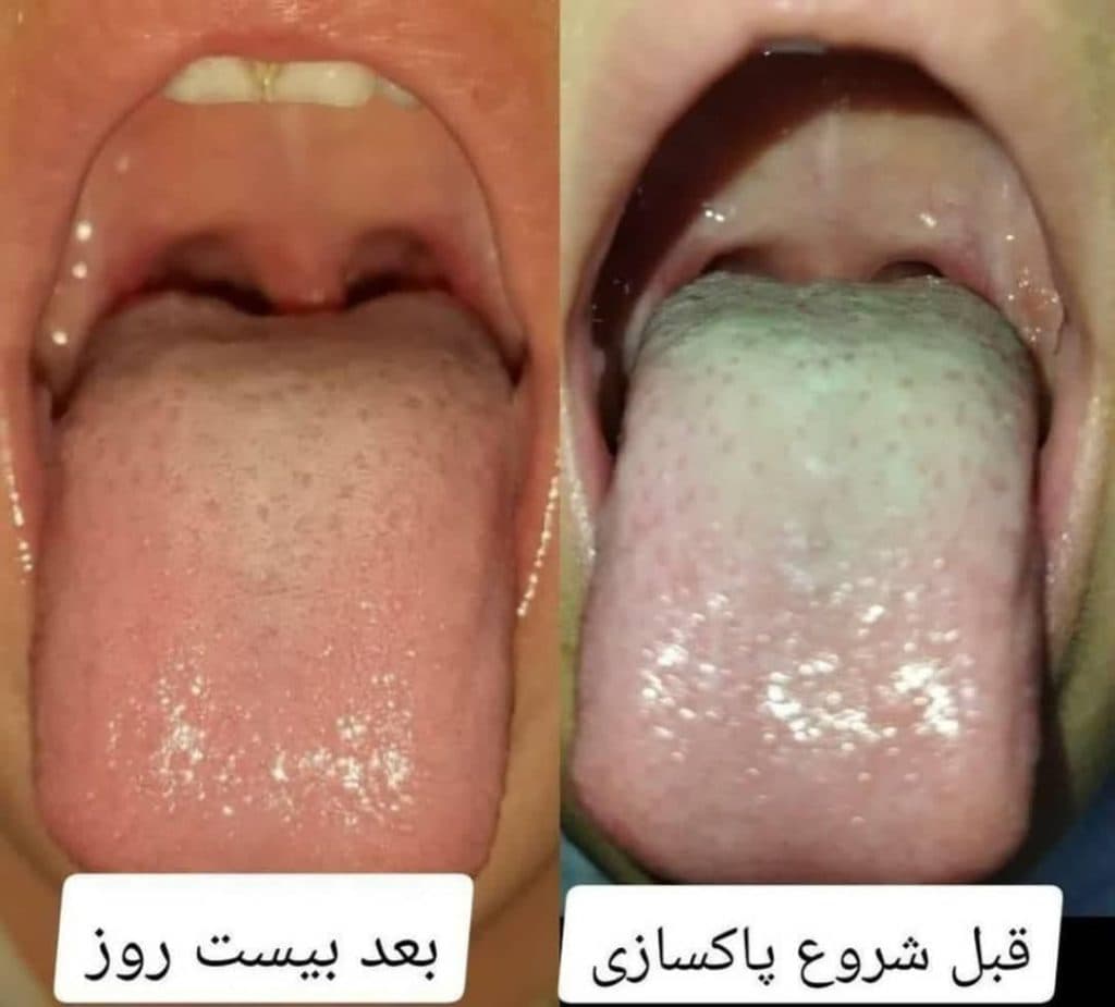 خدمات طب سنتی کهربا در زاهدان