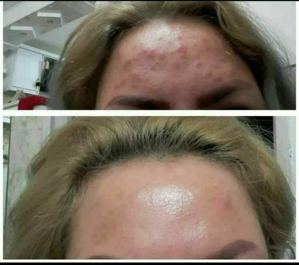 خدمات طب سنتی کهربا در زاهدان