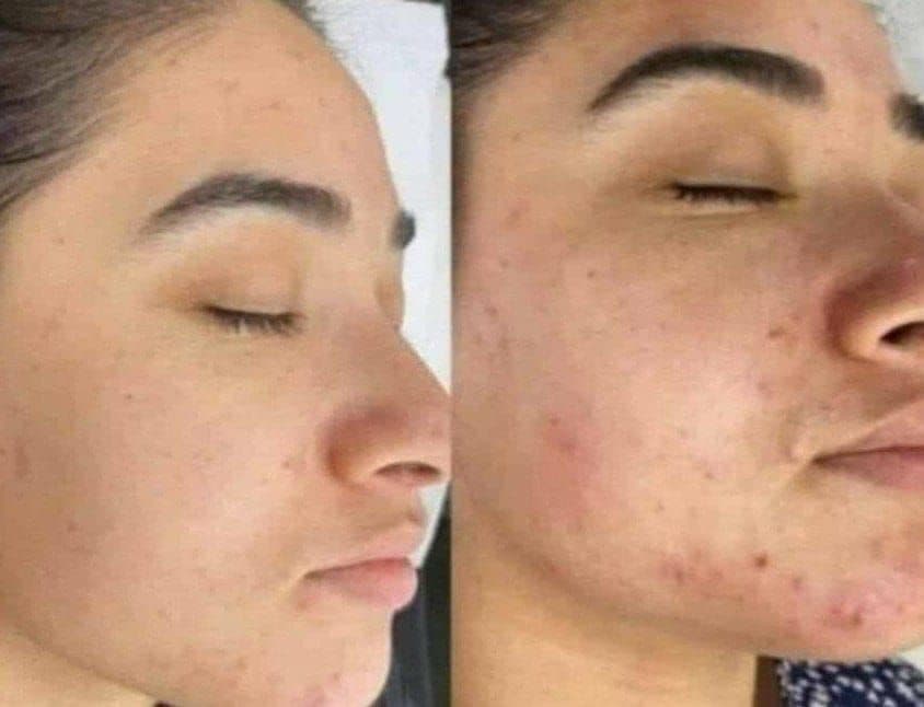 خدمات طب سنتی کهربا در زاهدان