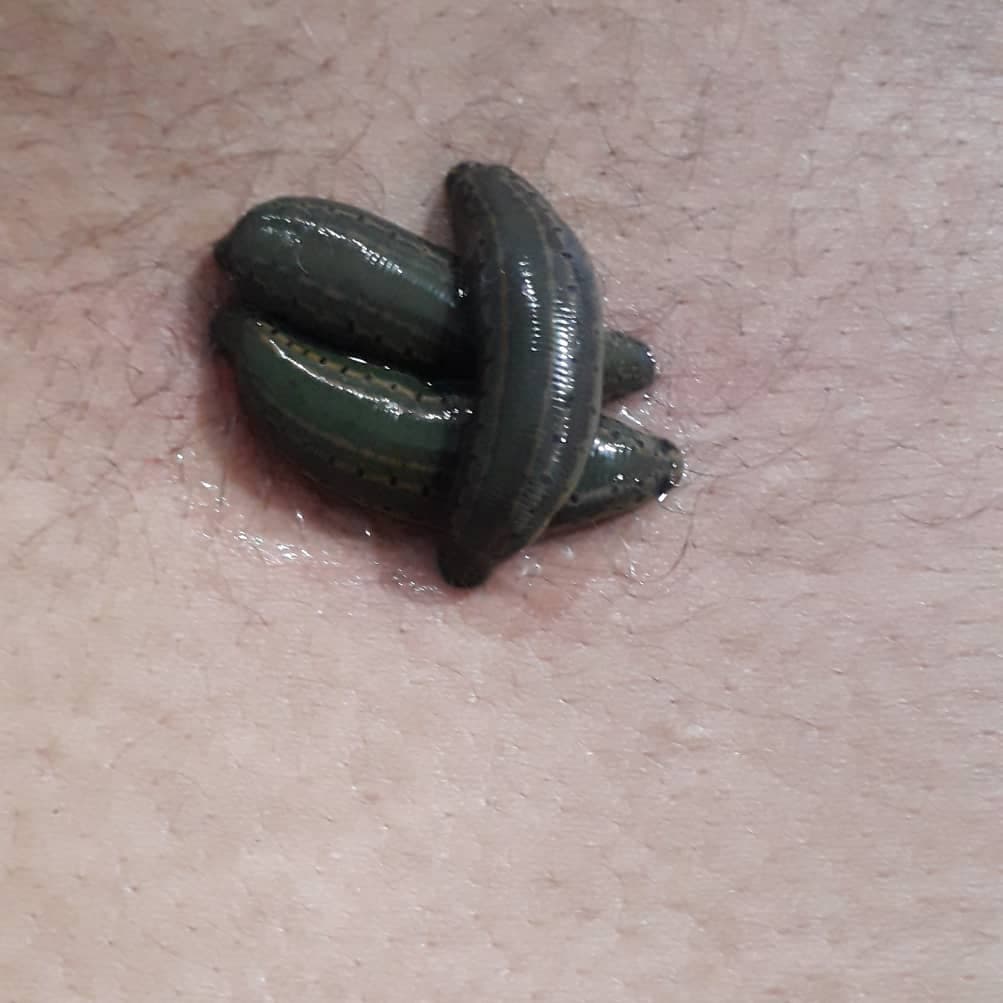 خدمات طب سنتی عامری در گلستان اهواز