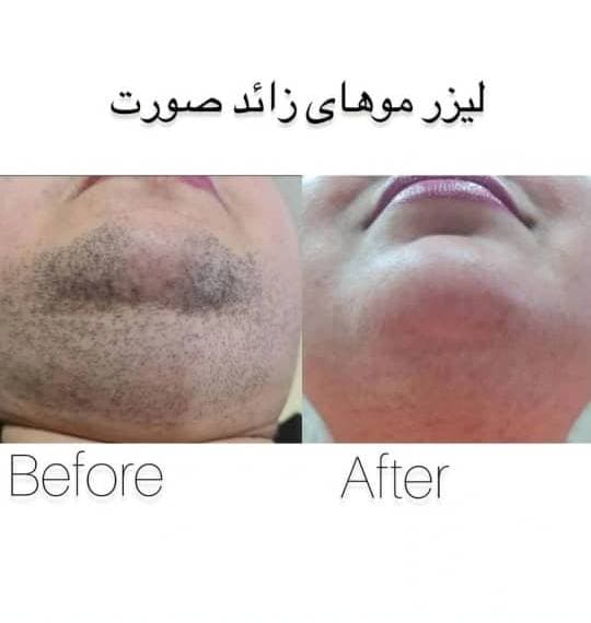 کلینیک لیزر و زیبایی مروارید در قم