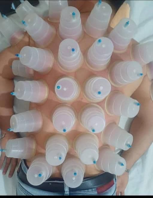 خدمات تخصصی حجامت و رگ گیری گل نرگس جمالی در شیراز