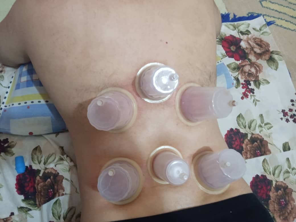 خدمات تخصصی حجامت و رگ گیری گل نرگس جمالی در شیراز