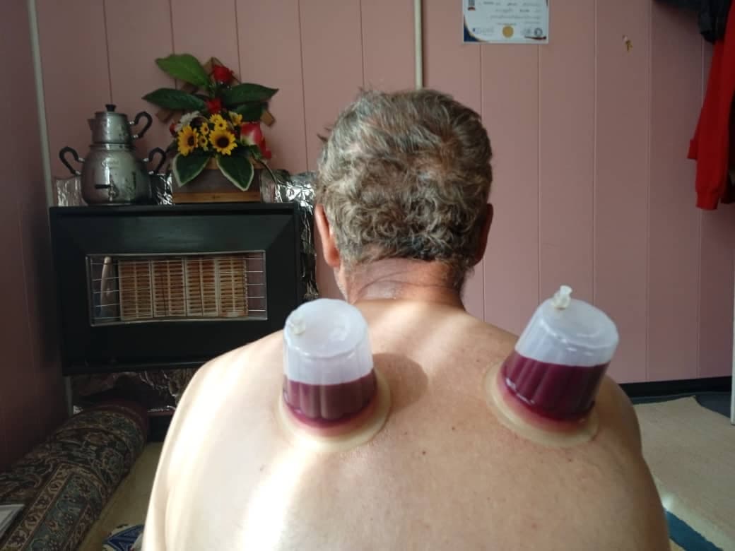 خدمات تخصصی حجامت و رگ گیری گل نرگس جمالی در شیراز