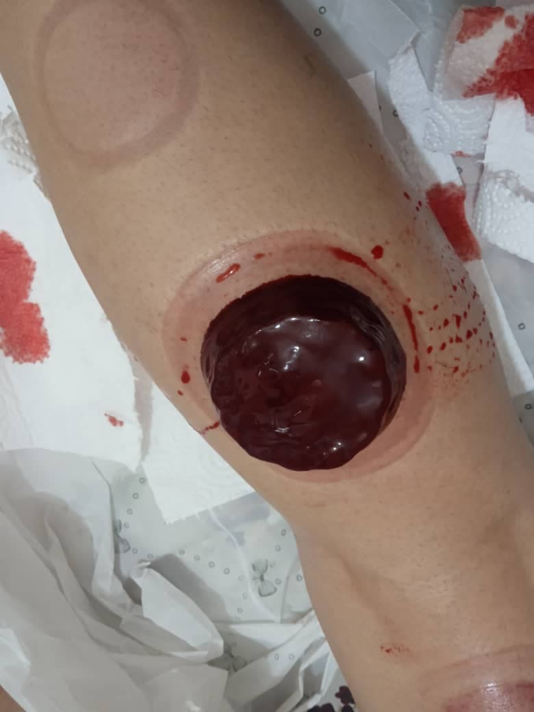 خدمات تخصصی حجامت و رگ گیری گل نرگس جمالی در شیراز