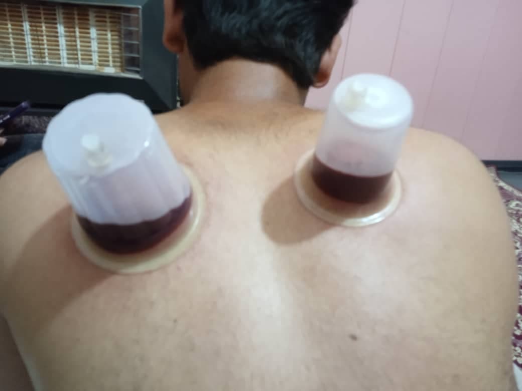 خدمات تخصصی حجامت و رگ گیری گل نرگس جمالی در شیراز