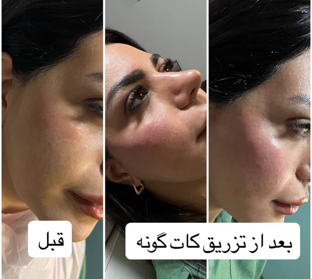 کلینیک زیبایی و لیزر دکتر عسکری در خیابان معلم رشت