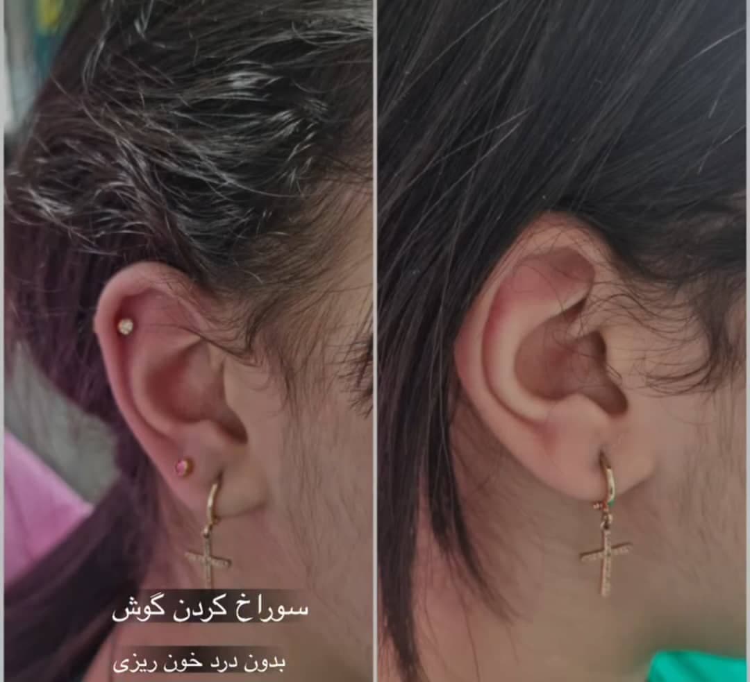 کلینیک زیبایی و لیزر دکتر عسکری در خیابان معلم رشت