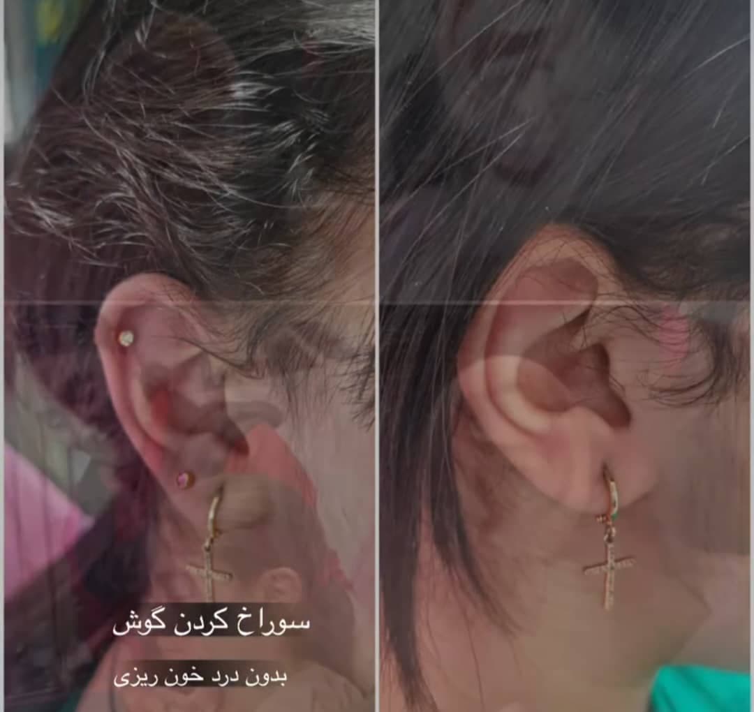 کلینیک زیبایی و لیزر دکتر عسکری در خیابان معلم رشت