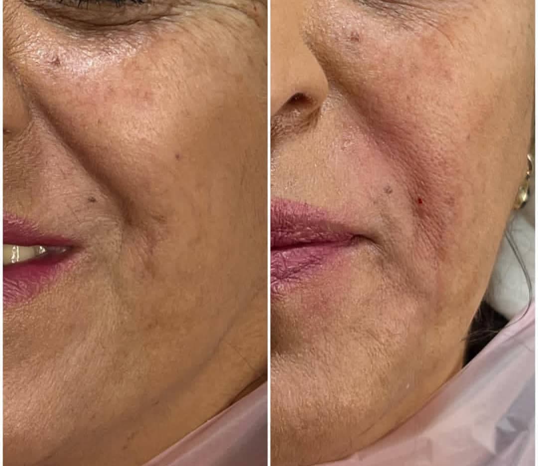 کلینیک زیبایی و لیزر دکتر عسکری در خیابان معلم رشت