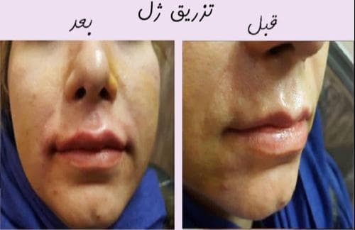 کلینیک زیبایی ماهرخ در شهید بهشتی کرج