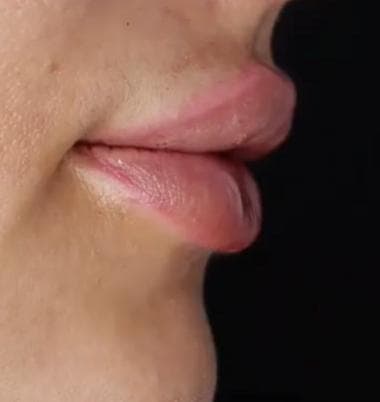 کلینیک زیبایی ماهرخ در شهید بهشتی کرج