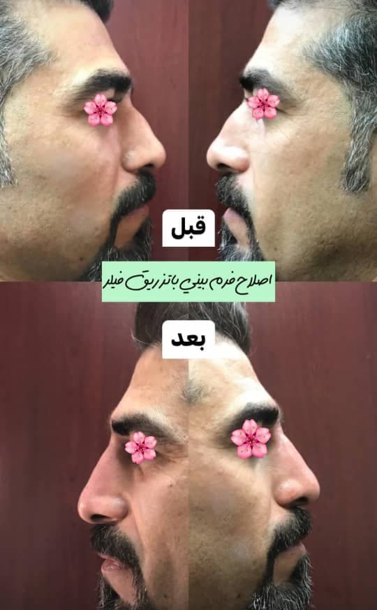 کلینیک زیبایی پوست و مو مروا در کرج