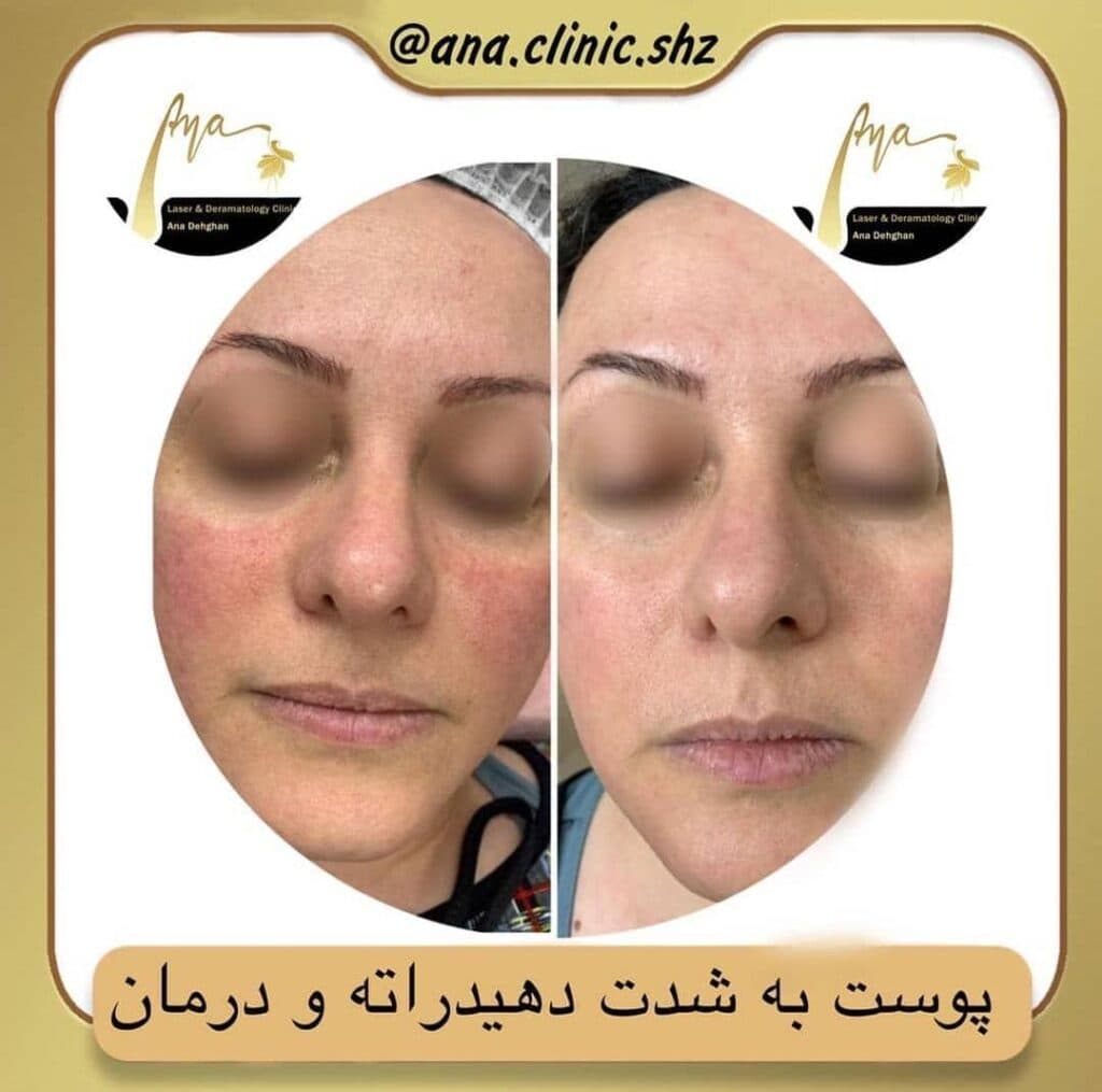 کلینیک زیبایی آنا در شیراز