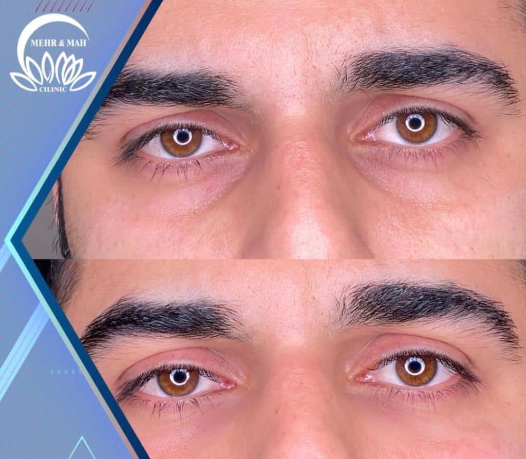 کلینیک زیبایی مهر و ماه در رشت