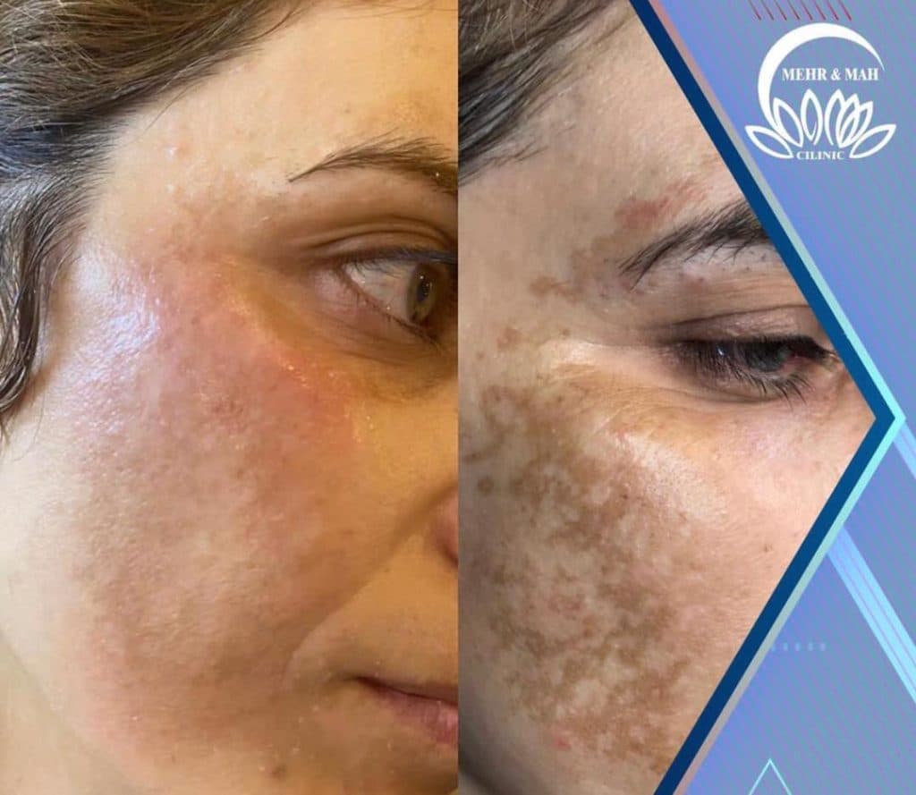 کلینیک زیبایی مهر و ماه در رشت