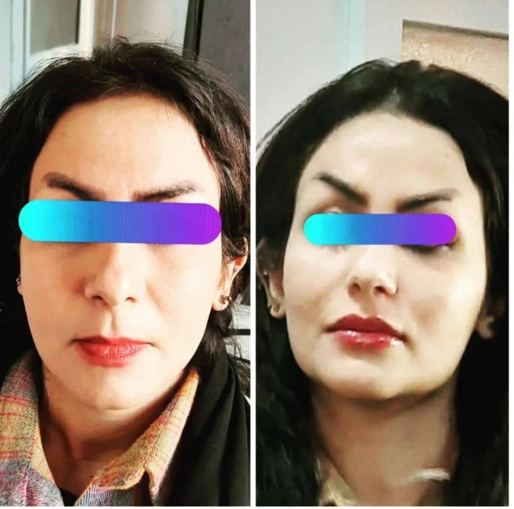 کلینیک زیبایی پوست و مو نیکو رویان نوژان در مشهد