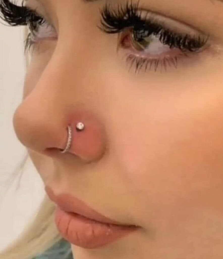 کلینیک زیبایی به سما در رشت