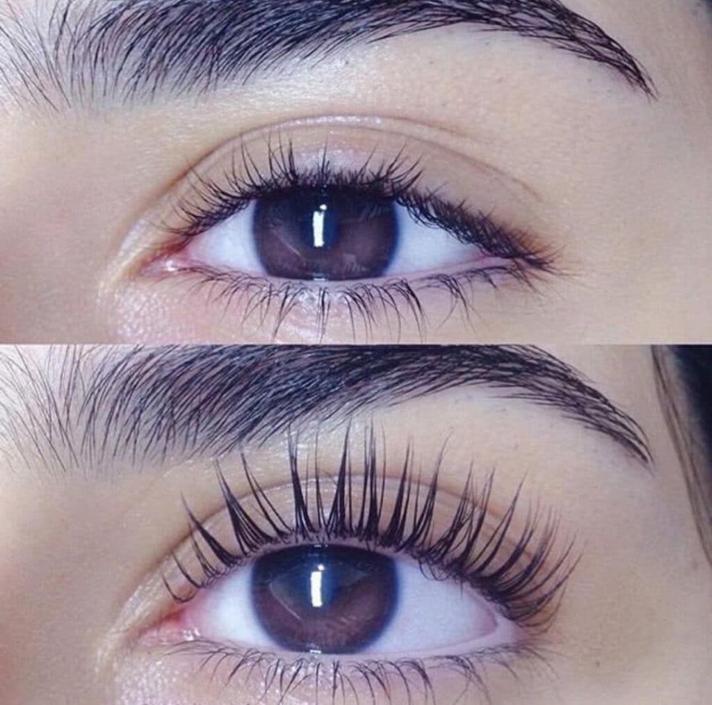 کلینیک زیبایی به سما در رشت