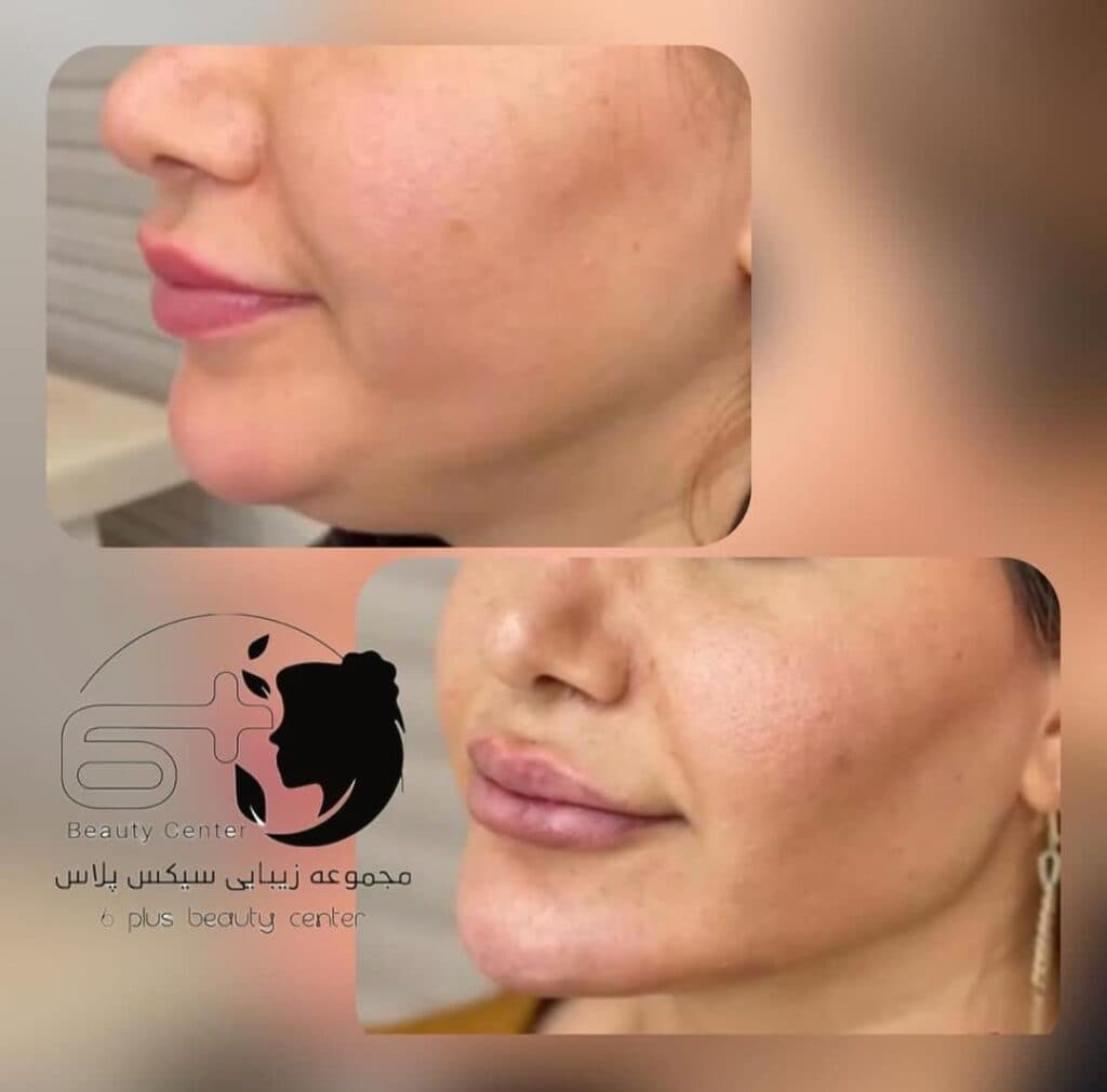 کلینیک زیبایی سیکس پلاس در شیراز
