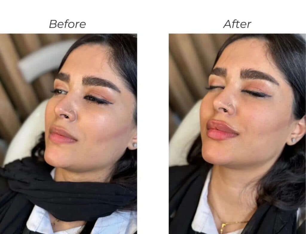 کلینیک زیبایی فلورا در مهران کرج