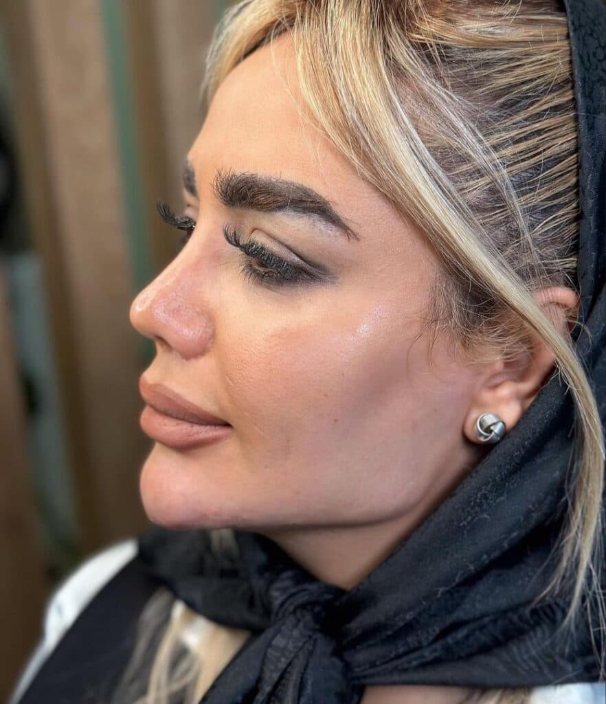 کلینیک زیبایی فلورا در مهران کرج