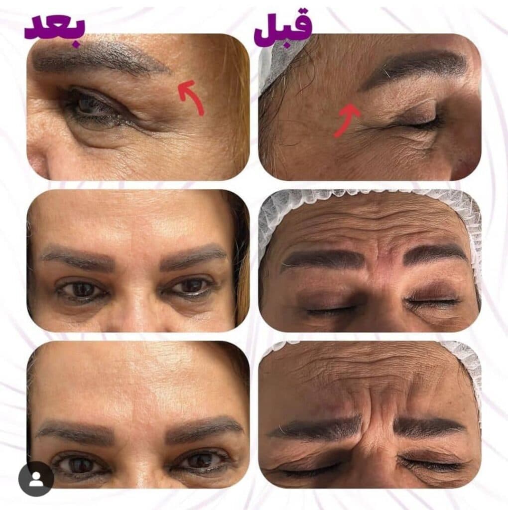 کلینیک زیبایی پوست و مو نلا در رشت