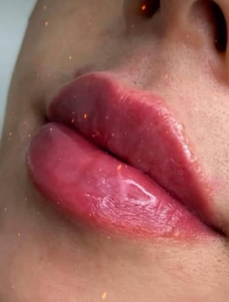 کلینیک زیبایی پوست و مو مانلی در کرج